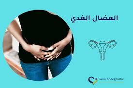 العضال الغدي   